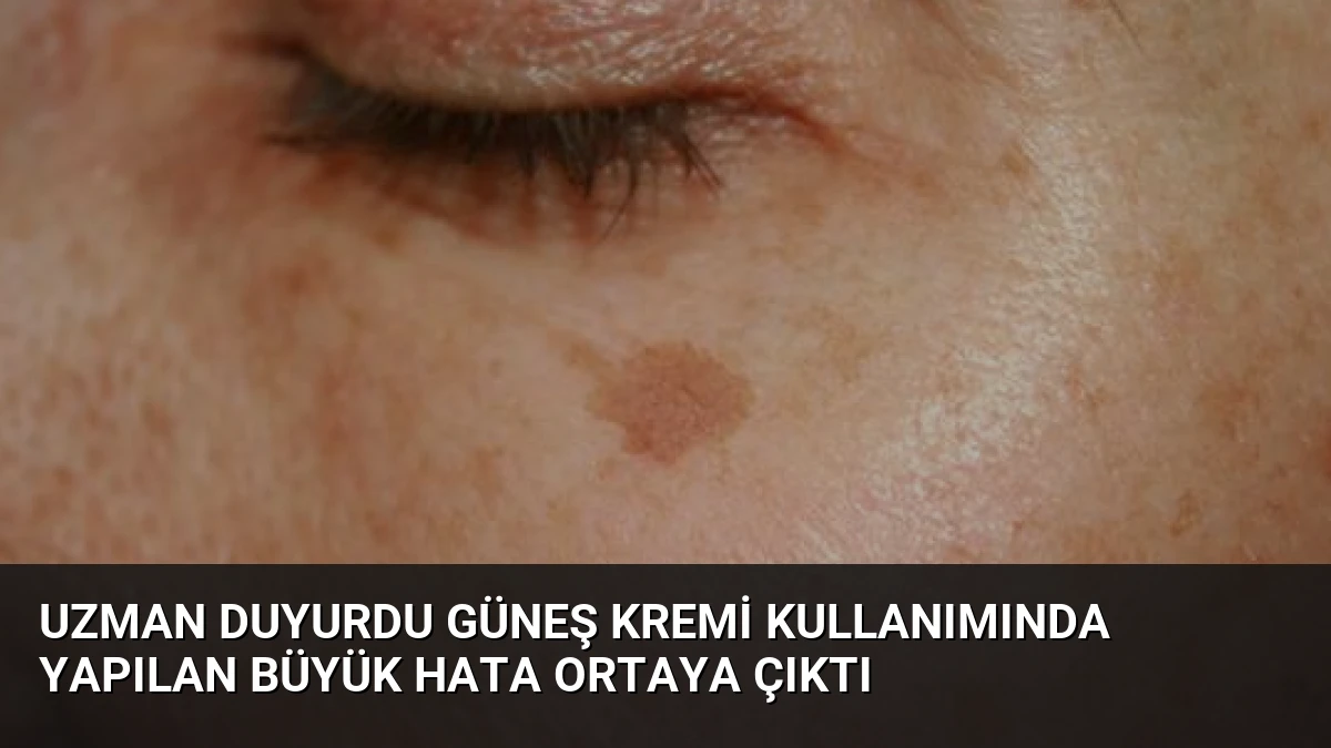 Uzman Duyurdu Güneş Kremi Kullanımında Yapılan Büyük Hata Ortaya Çıktı