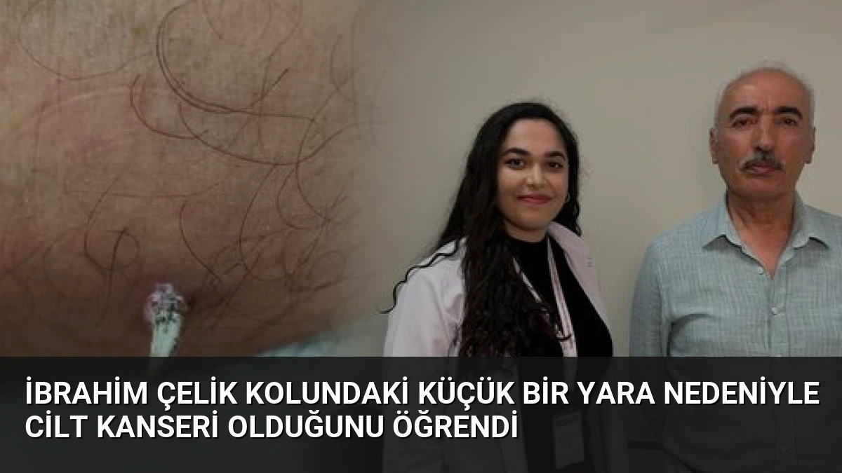 İbrahim Çelik Kolundaki Küçük Bir Yara Nedeniyle Cilt Kanseri Olduğunu Öğrendi