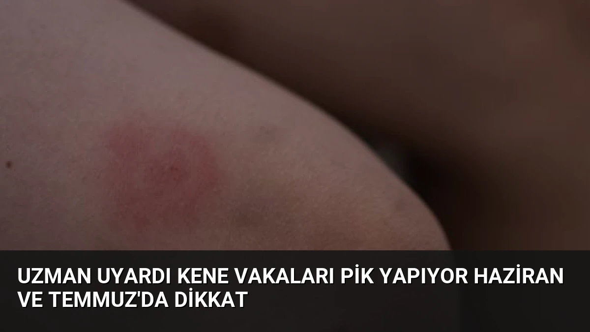 Uzman Uyardı Kene Vakaları Pik Yapıyor Haziran ve Temmuz’da Dikkat