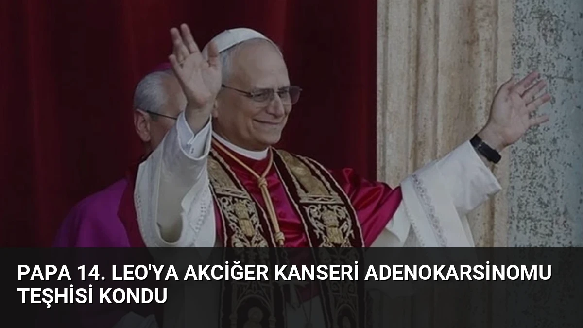 Papa 14. Leo’ya Akciğer Kanseri Adenokarsinomu Teşhisi Kondu